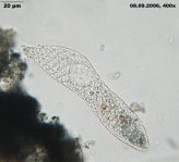 Lacrymaria-elegans_K.jpg