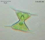 Staurodesmus_triangularis_K.jpg